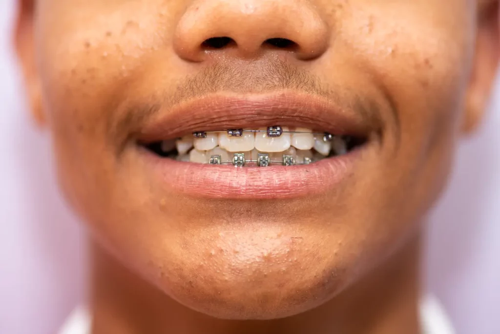 Aparat Damon Wrocław