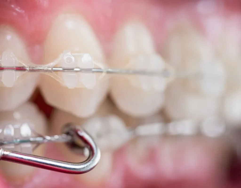 Aparat kryształowy Wrocław