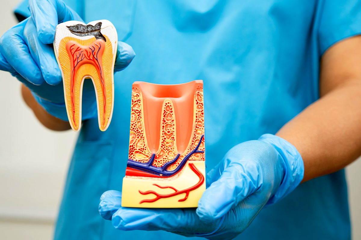 Leczenie kanałowe – wizyty, które powinien odbyć pacjent